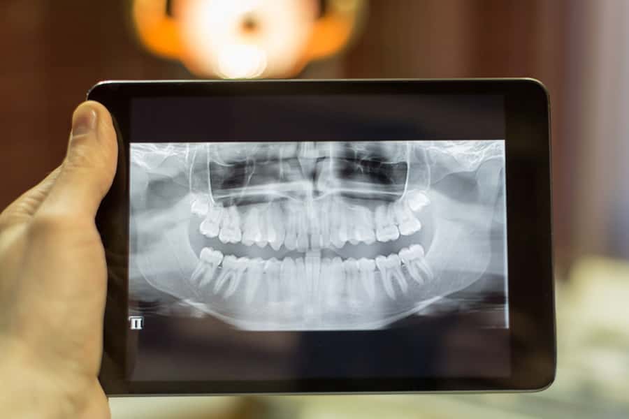 Mannheim Dental uses the digital radiography near Franklin Park, IL to instantly view your x-rays and enlarge the image to determine any dental problems you may have. The digital radiography captures a digital picture of teeth with their supporting bone structures to create an individualized treatment plan just for you! Digital Radiography in Franklin Park, IL